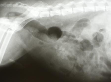 Bladder stones