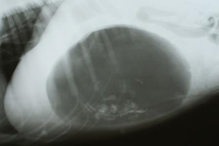 Xray of gastric torsion