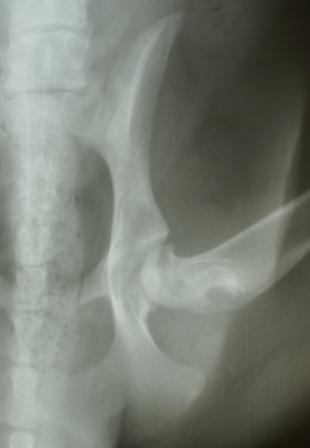 Hip x-ray