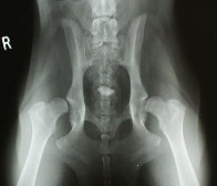 Hip dysplasia