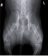 Hip dysplasia