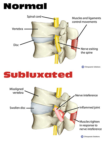 veterinary chiropractic treats subluxations