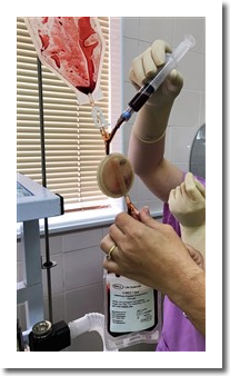 Platelet Rich Plasma (PRP) Therapy Kit