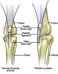 patella luxation